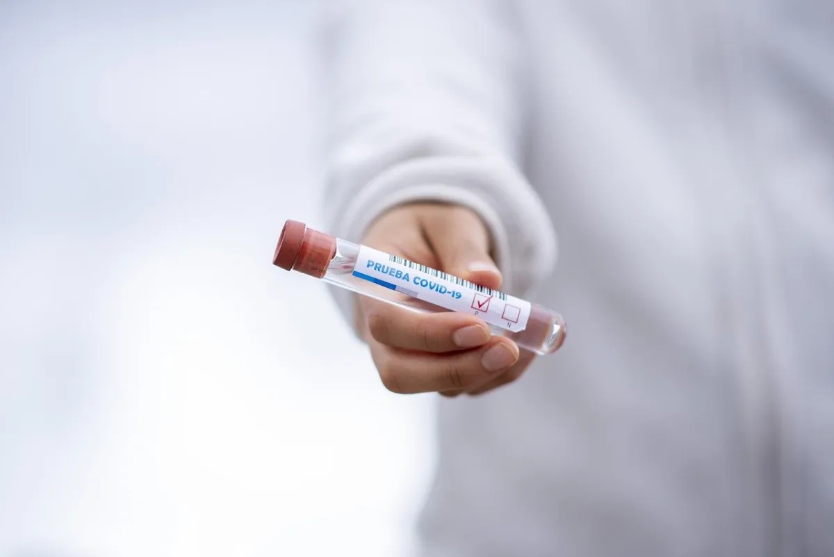 Novel test can identify patients at risk of severe COVID-19