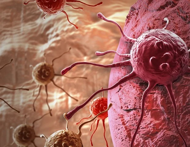 Colorectal cancer patients can benefit from surveillance with chest imaging