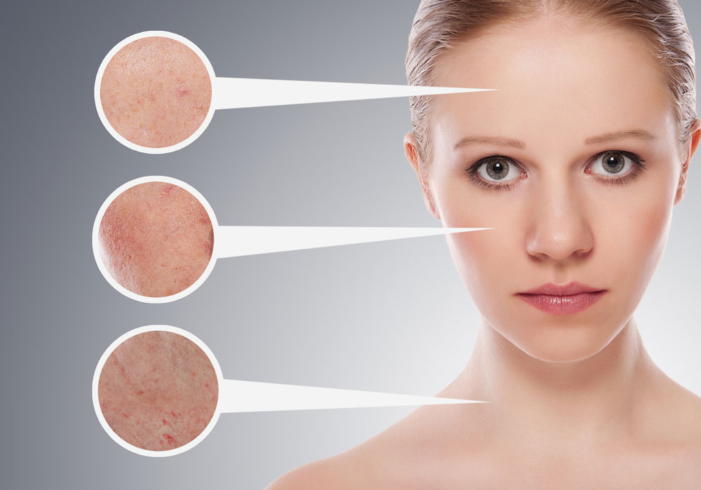 Skin problems that may be happening due to poor gut health
