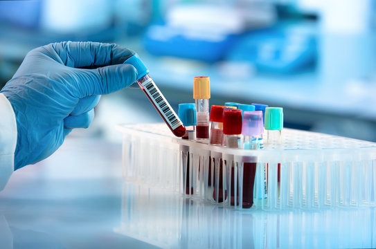 5 essential blood tests you must do every year